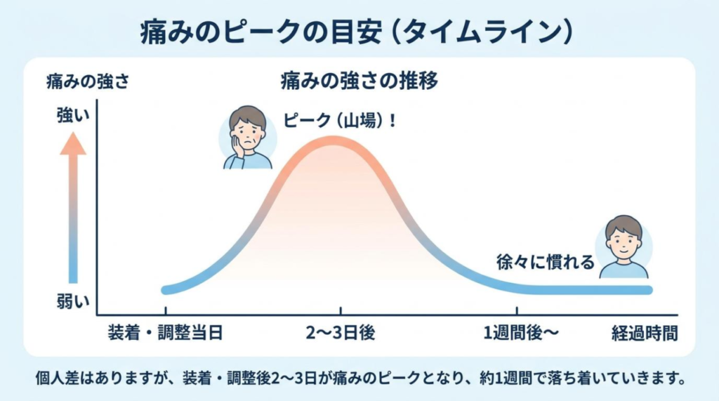 痛みのピークはいつまで？タイミング別の特徴